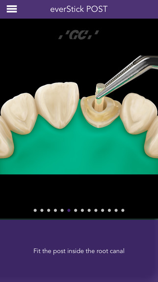 GC Restorative Guide 2.0: Довідник з Відновлювальної Стоматології