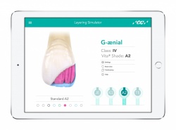 GC Restorative Guide 2.0: Довідник з Відновлювальної Стоматології