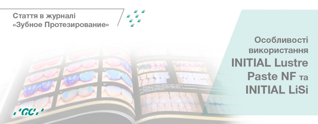 Стаття, присвячена INITIAL Lustre Paste NF та INITIAL LiSi