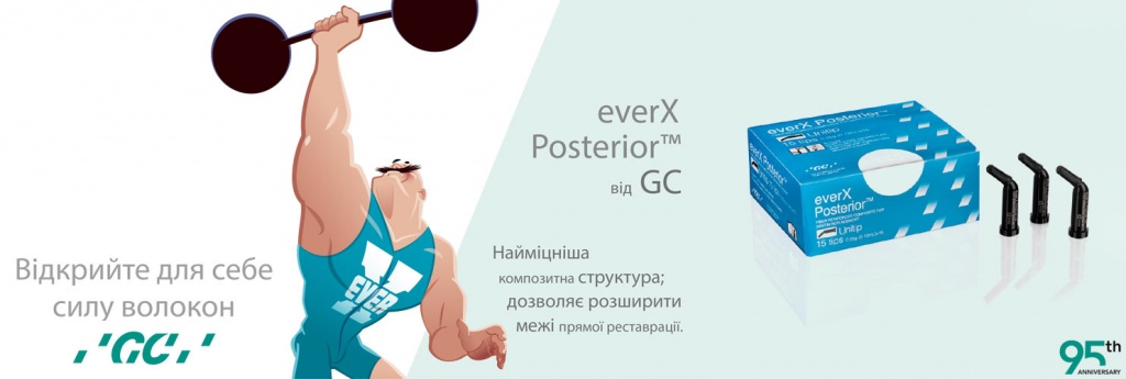 Стаття про EVERX POSTERIOR в журналі "Современная Стоматология"