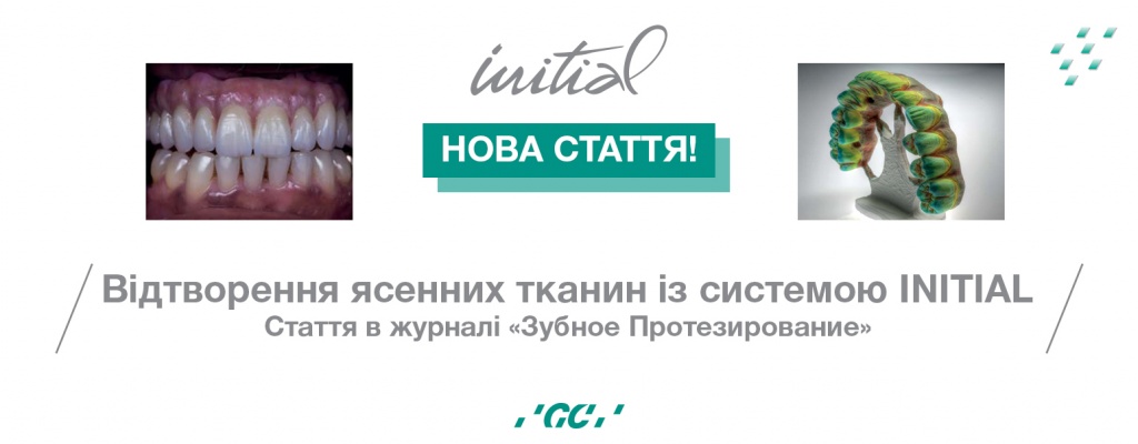 Стаття, присвячена ясенній естетиці системи INITIAL