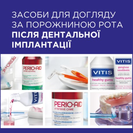 Засоби для догляду за порожниною рота після дентальної імплантації виробництва компанії DENTAID (Іспанія)