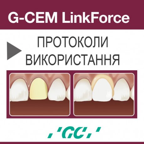G-CEM LinkForce (протоколи використання)